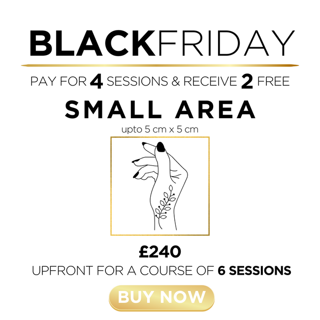 q) Tattoo Removal - Small Area - 2 Sessions FREE!