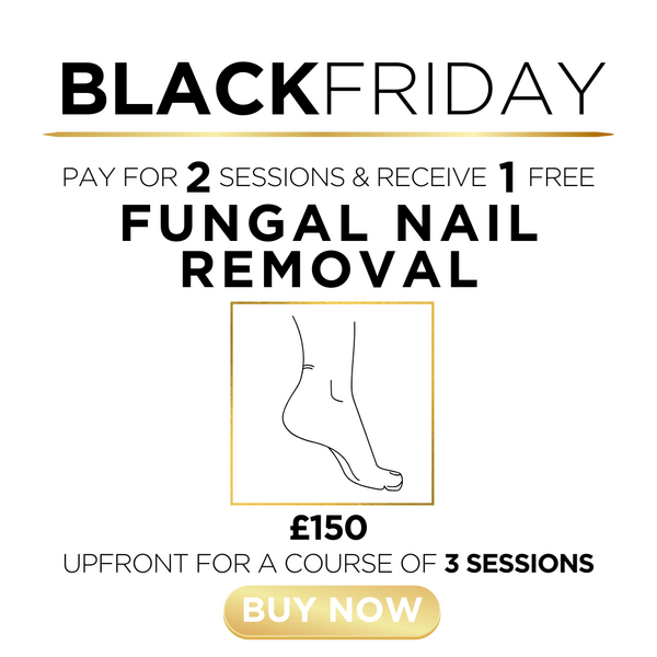 y) Fungal Toe Removal - 1 Session FREE!
