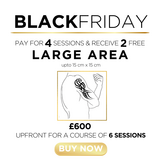 o) Tattoo Removal - Large Area - 2 Sessions FREE!