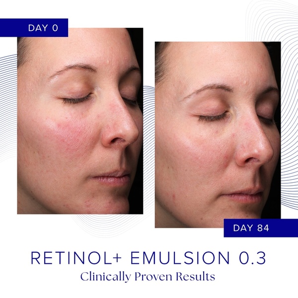iS Clinical RETINOL+ EMULSION