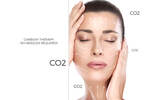 Carboxy Facial Therapy