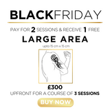r) Tattoo Removal - Large Area - 1 Session FREE!