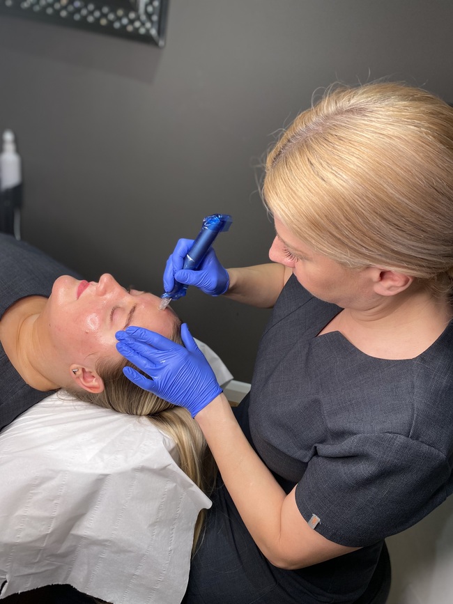 Nano Needling x3 (£112 per treatment)
