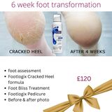 Foot Transformation