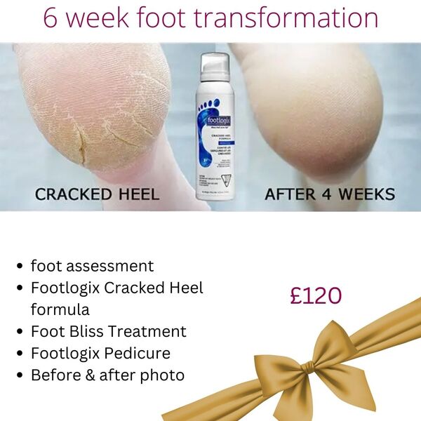 Foot Transformation