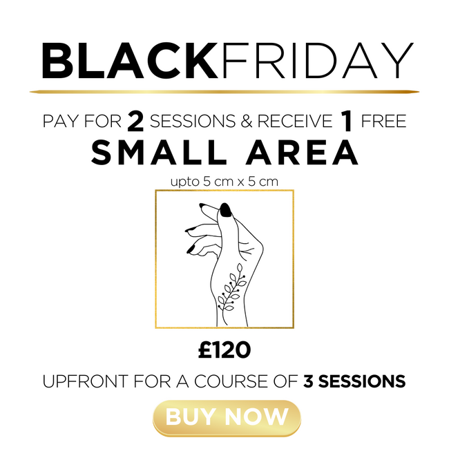 t) Tattoo Removal - Small Area - 1 Session FREE!