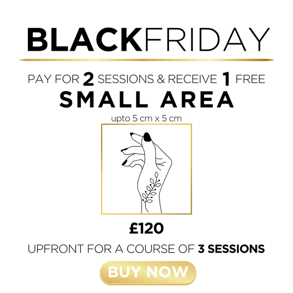 t) Tattoo Removal - Small Area - 1 Session FREE!