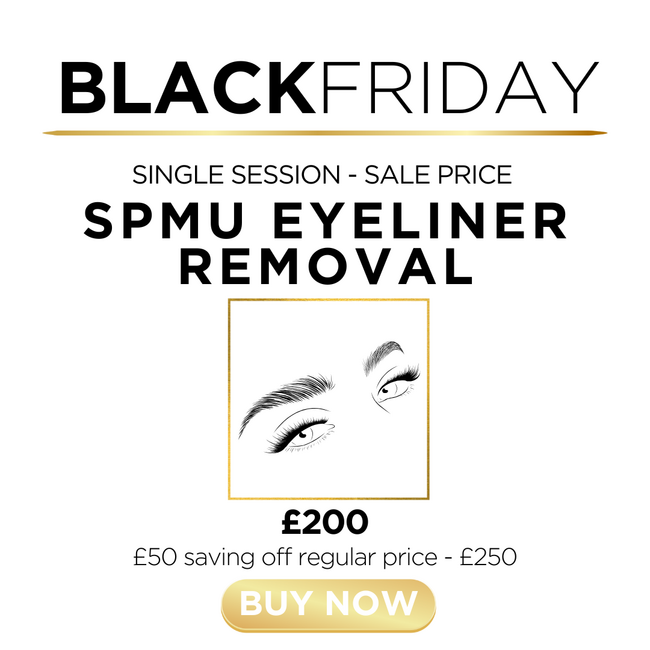 u) SPMU Eyeliner Removal - Single Session!