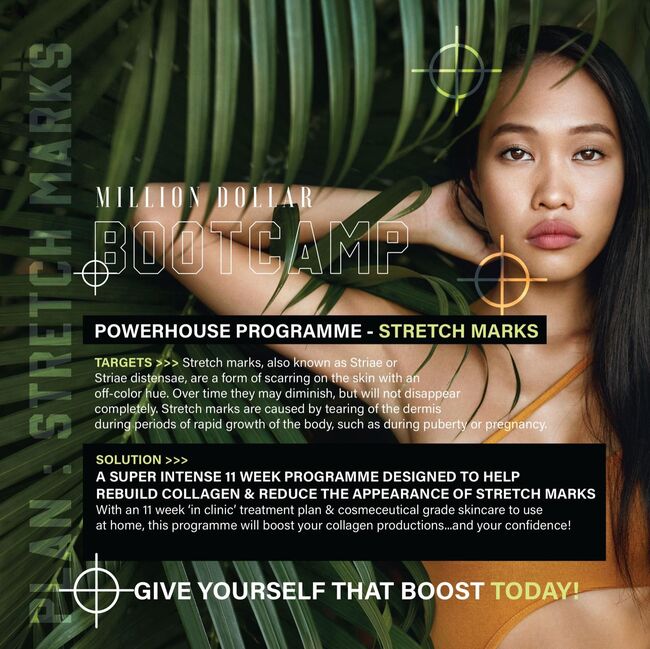 Million Dollar Stretchmarks/Cellulite Bootcamp